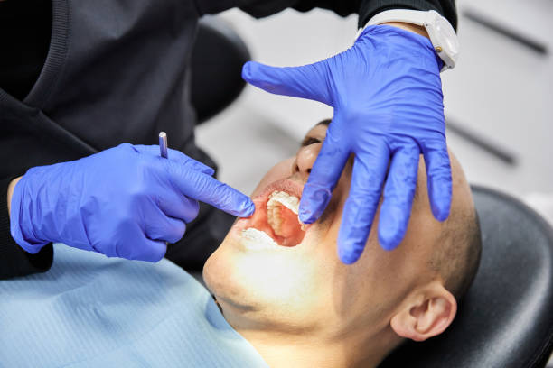 Best Emergency Root Canal Treatment in Athens, WV