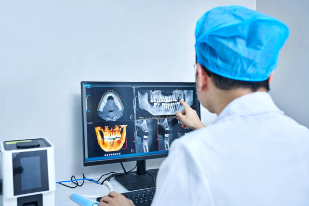 Best Emergency Dentist for Lost Fillings or Crowns in Athens, WV